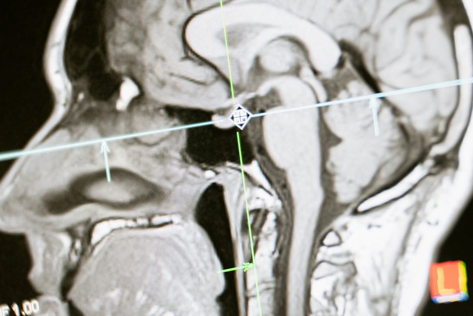 Chiari